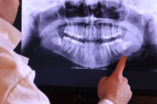 Best Emergency Dental Services for Seniors in Wesleyville, PA